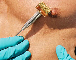 Roller Drum – Gold